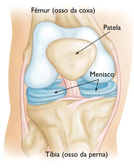 Cirurgia de menisco - 1