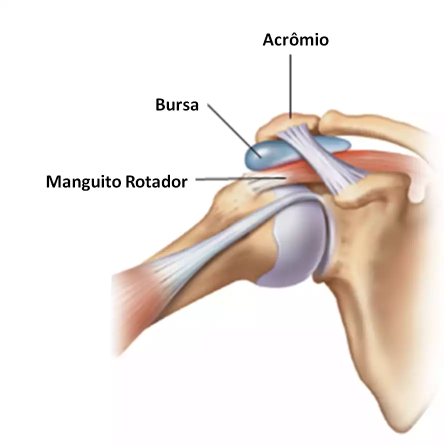 Tratamento para bursite no ombro